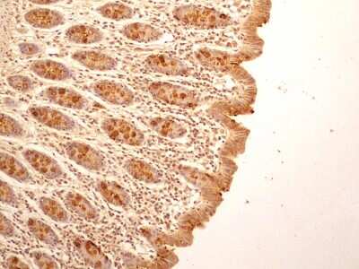 Immunohistochemistry-Paraffin: IL-27R alpha/WSX-1/TCCR Antibody (34N4G11) - BSA Free [NBP2-19015]