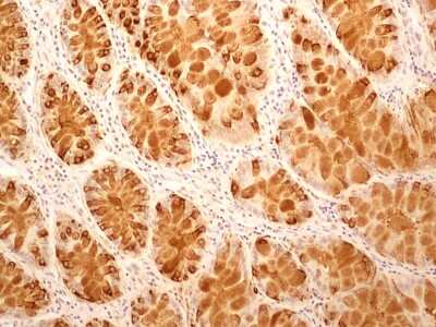 Immunohistochemistry-Paraffin: IL-27R alpha/WSX-1/TCCR Antibody (34N4G11) - BSA Free [NBP2-19015]