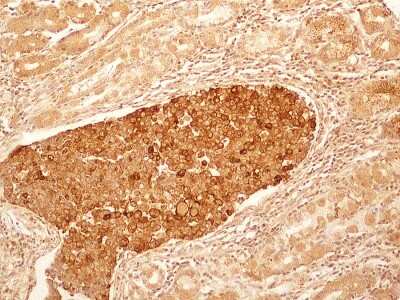 Immunohistochemistry-Paraffin: IL-27R alpha/WSX-1/TCCR Antibody (34N4G11) - BSA Free [NBP2-19015]