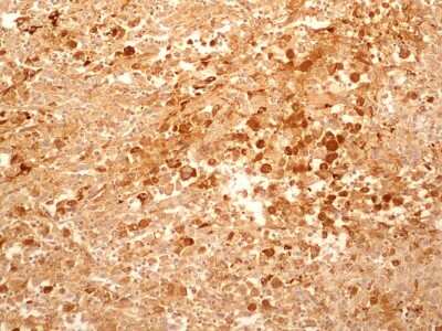 Immunohistochemistry-Paraffin: IL-27R alpha/WSX-1/TCCR Antibody (34N4G11) - BSA Free [NBP2-19015]