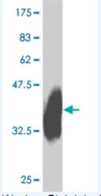 Western Blot: IL-27R alpha/WSX-1/TCCR Antibody (8G9) [H00009466-M01]