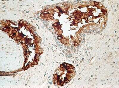 Immunohistochemistry: IL-27R alpha/WSX-1/TCCR Antibody (34N4G11) - Azide and BSA Free [NBP2-80807]