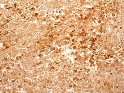Immunohistochemistry: IL-27R alpha/WSX-1/TCCR Antibody (34N4G11) - Azide and BSA Free [NBP2-80807]