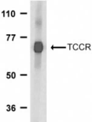 Western Blot: IL-27R alpha/WSX-1/TCCR AntibodyBSA Free [NBP1-76728]