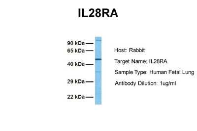 Western Blot: IL-28R alpha/IFN-lambda R1 Antibody [NBP1-69635]