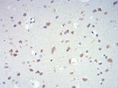 Immunohistochemistry: IL-28A/IFN-lambda 2 Antibody (7B9A4) - BSA Free [NBP2-52494]