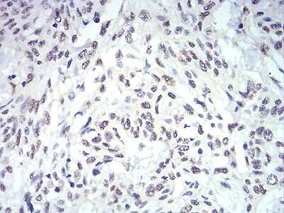 Immunohistochemistry: IL-28A/IFN-lambda 2 Antibody (7B9A4) - BSA Free [NBP2-52494]