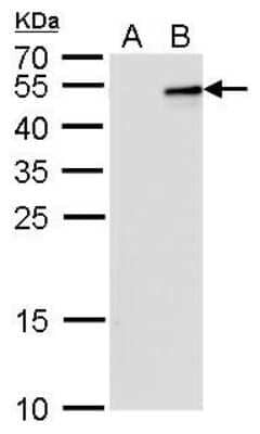 Western Blot: IL-28B/IFN-lambda 3 Antibody (2512) [NBP2-43739]