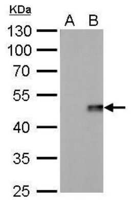 Western Blot: IL-28B/IFN-lambda 3 Antibody (617) [NBP2-43738]