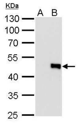 Western Blot: IL-28B/IFN-lambda 3 Antibody (727) [NBP2-43737]