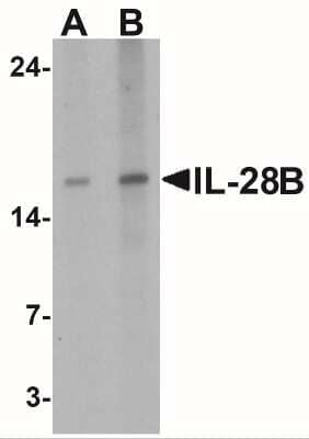 Western Blot: IL-28B/IFN-lambda 3 AntibodyBSA Free [NBP2-41236]