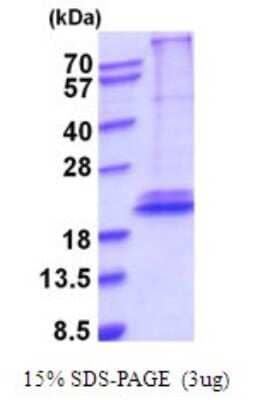 SDS-PAGE: Recombinant Human IL-28B/IFN-lambda 3 His Protein [NBP2-52083]