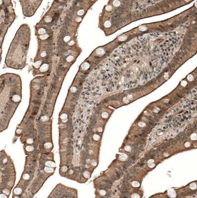 Immunohistochemistry-Paraffin: IL-28R alpha/IFN-lambda R1 Antibody [NBP1-84381]