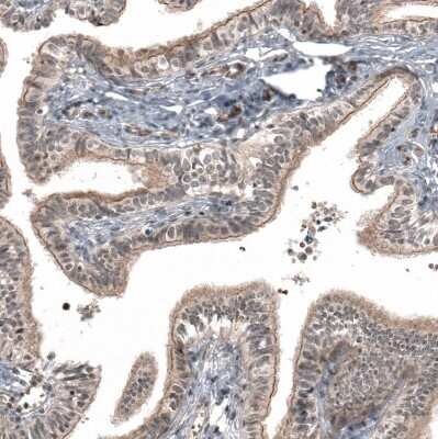 Immunohistochemistry-Paraffin: IL-28R alpha/IFN-lambda R1 Antibody [NBP1-84381]