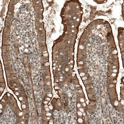 Immunohistochemistry-Paraffin: IL-28R alpha/IFN-lambda R1 Antibody [NBP1-84381]