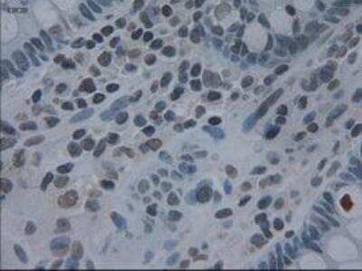 Immunohistochemistry-Paraffin: IL-3 Antibody (OTI3B11) [NBP1-47806]