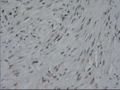 Immunohistochemistry-Paraffin: IL-3 Antibody (OTI3B11) [NBP1-47806]