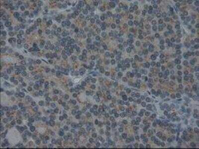Immunohistochemistry-Paraffin: IL-3 Antibody (OTI3B11) [NBP1-47806]