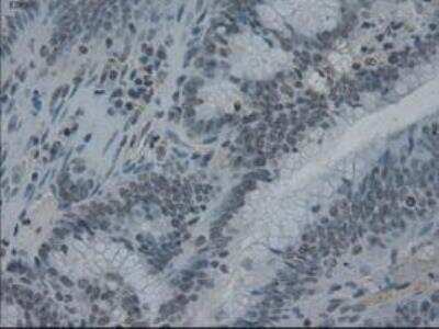 Immunohistochemistry-Paraffin: IL-3 Antibody (OTI3B11) [NBP1-47806]
