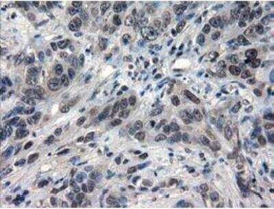 Immunohistochemistry-Paraffin: IL-3 Antibody (OTI3B11) [NBP1-47806]