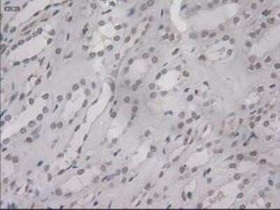 Immunohistochemistry: IL-3 Antibody (OTI3B11) - Azide and BSA Free [NBP2-71023]
