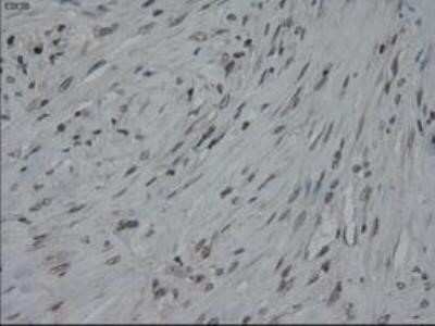 Immunohistochemistry: IL-3 Antibody (OTI3B11) - Azide and BSA Free [NBP2-71023]