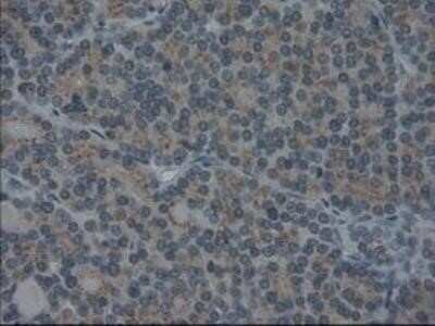 Immunohistochemistry: IL-3 Antibody (OTI3B11) - Azide and BSA Free [NBP2-71023]