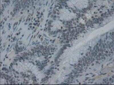 Immunohistochemistry: IL-3 Antibody (OTI3B11) - Azide and BSA Free [NBP2-71023]