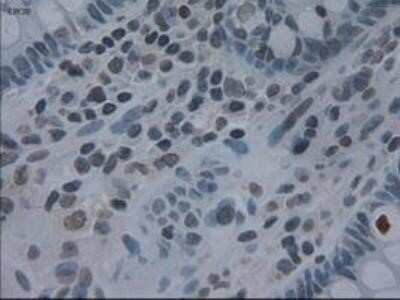 Immunohistochemistry: IL-3 Antibody (OTI3B11) - Azide and BSA Free [NBP2-71023]