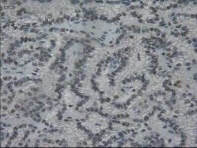 Immunohistochemistry: IL-3 Antibody (OTI3B11) - Azide and BSA Free [NBP2-71023]