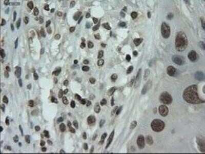 Immunohistochemistry: IL-3 Antibody (OTI3B11) - Azide and BSA Free [NBP2-71023]
