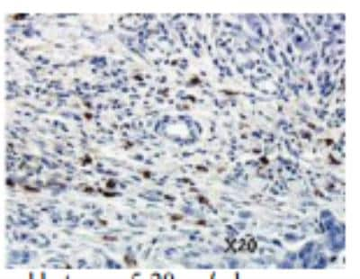 Immunohistochemistry: IL-3R alpha/CD123 Antibody (107D2.08) [DDX0300P-100]