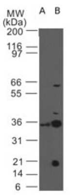 Western Blot: IL-3R alpha/CD123 Antibody (18N6B12) [NBP2-27225]