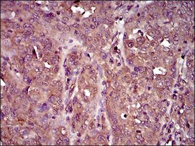 Immunohistochemistry-Paraffin: IL-3R alpha/CD123 Antibody (8E11C5) - BSA Free [NBP2-37354]