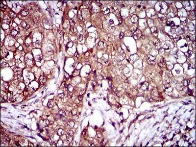 Immunohistochemistry: IL-3R alpha/CD123 Antibody (8E11C5) - BSA Free [NBP2-37354]