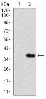 Western Blot: IL-3R alpha/CD123 Antibody (8E11C5)BSA Free [NBP2-37354]