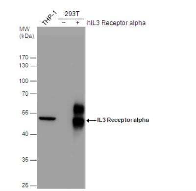 Western Blot: IL-3R alpha/CD123 Antibody [NBP2-16953]