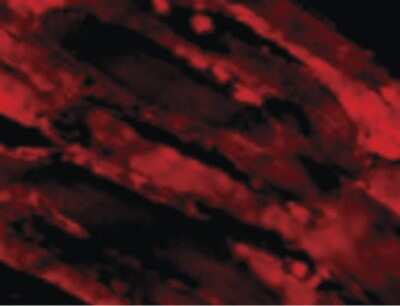 Immunofluorescence: IL-31 Antibody - BSA Free [NBP1-03044]