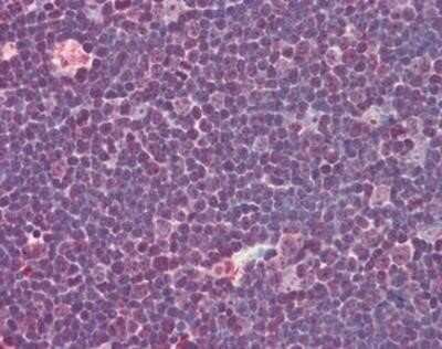 Immunohistochemistry-Paraffin: IL-31 Antibody - BSA Free [NBP1-03044]