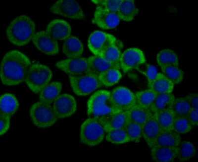 Immunocytochemistry/ Immunofluorescence: IL-31 Antibody (8-C3) [NBP2-80396]