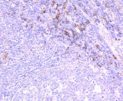 Immunohistochemistry-Paraffin: IL-31 Antibody (8-C3) [NBP2-80396]