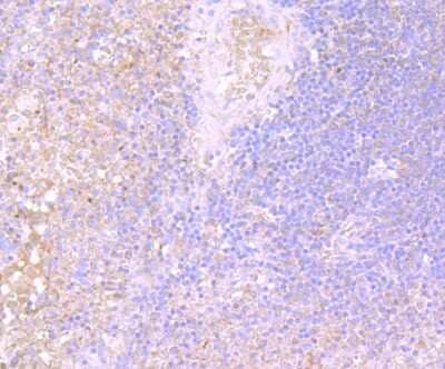 Immunohistochemistry-Paraffin: IL-31 Antibody (8-C3) [NBP2-80396]