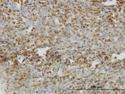 Immunohistochemistry-Paraffin: IL-31RA Antibody (3A10) [H00133396-M01]