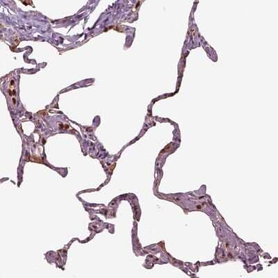 Immunohistochemistry-Paraffin: IL-31RA Antibody [NBP2-68866]