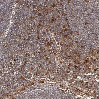 Immunohistochemistry-Paraffin: IL-32 Antibody [NBP1-82560]