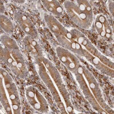 Immunohistochemistry-Paraffin: IL-32 Antibody [NBP1-82560]