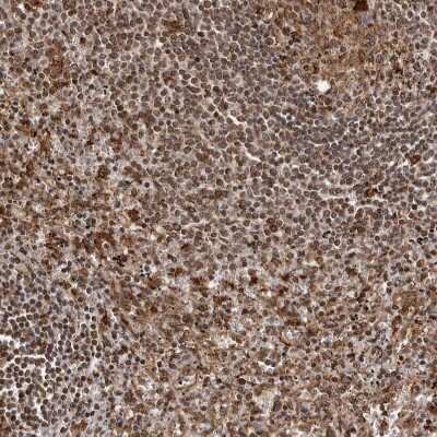 Immunohistochemistry-Paraffin: IL-32 Antibody [NBP1-82560]