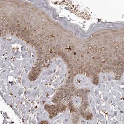 Immunohistochemistry-Paraffin: IL-32 Antibody [NBP1-82560]