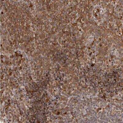 Immunohistochemistry-Paraffin: IL-32 Antibody [NBP1-82560]