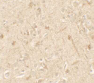 Immunohistochemistry: IL-36 alpha/IL-1F6 Antibody - BSA Free [NBP2-41238]